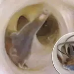 Schokkende video: kronkelende wormen ontdekt in buik van man