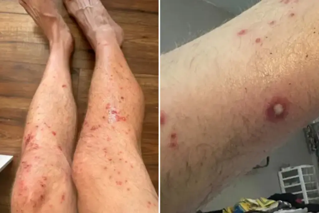 Deelnemers Tough Mudder kampen met huiduitslag en koorts na race in Californië