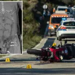 Motorrijder verliest teelbal in buik na ongeval: een bijzonder geval uit Italië