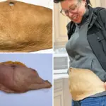 Vrouw transformeert 2 kilo overtollige huid tot menselijk leer