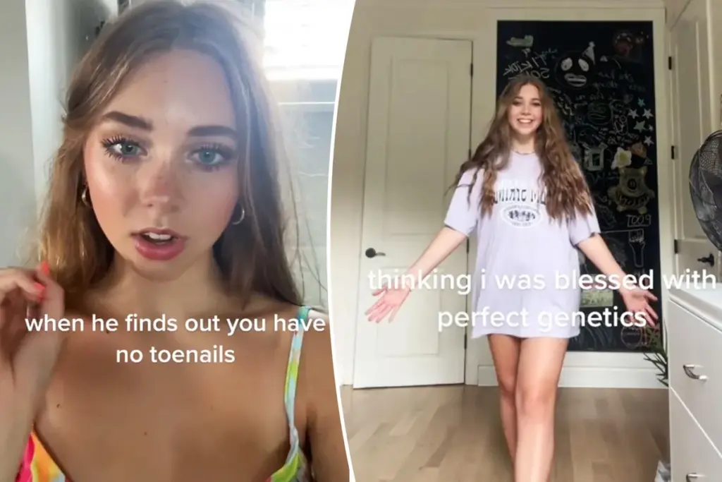 Geboren zonder teennagels — nu ben ik een viraal fenomeen op TikTok
