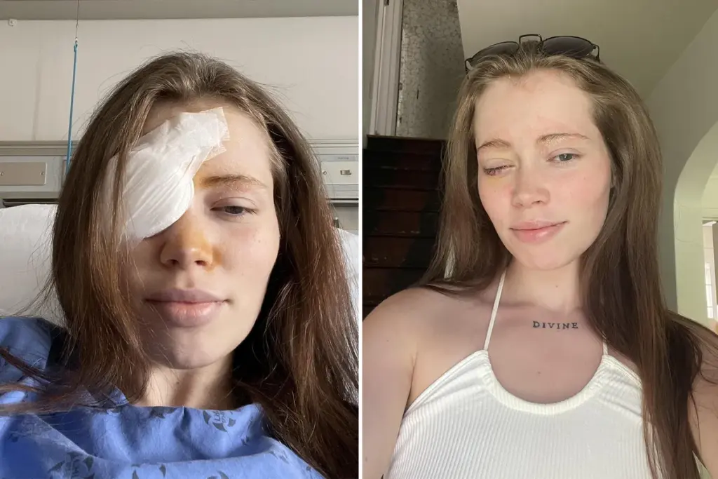 Tranen van geluk: waarom de verwijdering van mijn oog het beste medicijn tegen pijn was