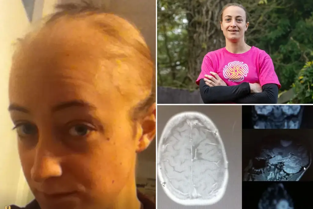 Ik moest met spoed geopereerd worden aan een hersentumor — ineens sprak ik alleen nog Frans