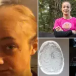 Ik moest met spoed geopereerd worden aan een hersentumor — ineens sprak ik alleen nog Frans