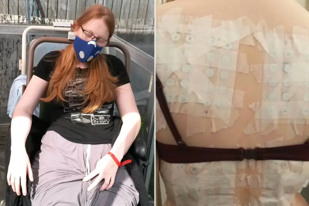 Ineens allergisch voor bijna alles: hoe ik met vier voedingsmiddelen mijn leven terugkreeg