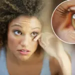 Het is het seizoen van wimperuitval — veelvoorkomende symptomen en risico’s