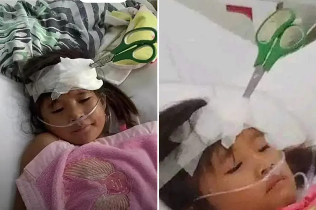 9-jarig meisje herstelt na week lang met schaar in haar hoofd
