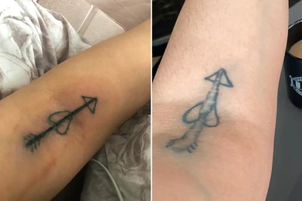 Rechtenstudent geeft €1.600 uit om gênante tattoo te laten coveren — die leek op een harige piemel