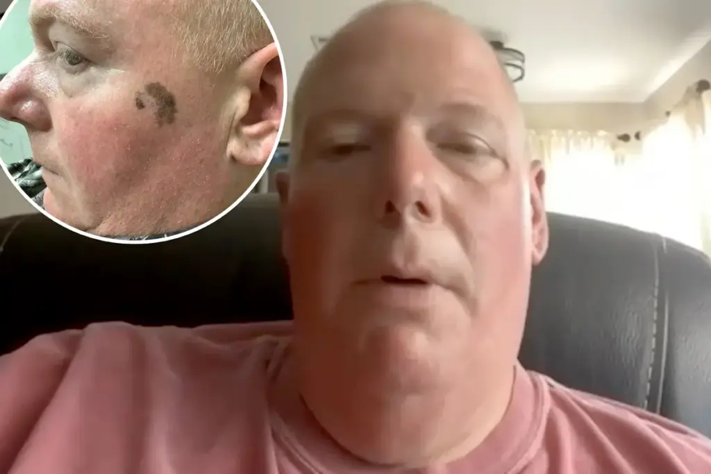 Een dermatoloog sprak mij aan over een vlek op mijn gezicht — het bleek kanker