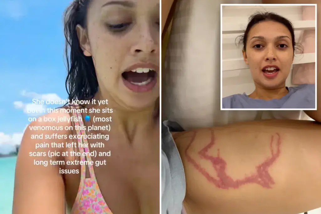 Influencer legt per ongeluk vast hoe ze gestoken wordt door dodelijke kubuskwal