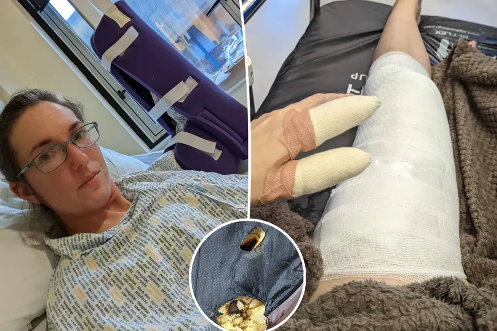 Vape ontploft in broekzak: vrouw uit Dorset loopt ernstige brandwonden op